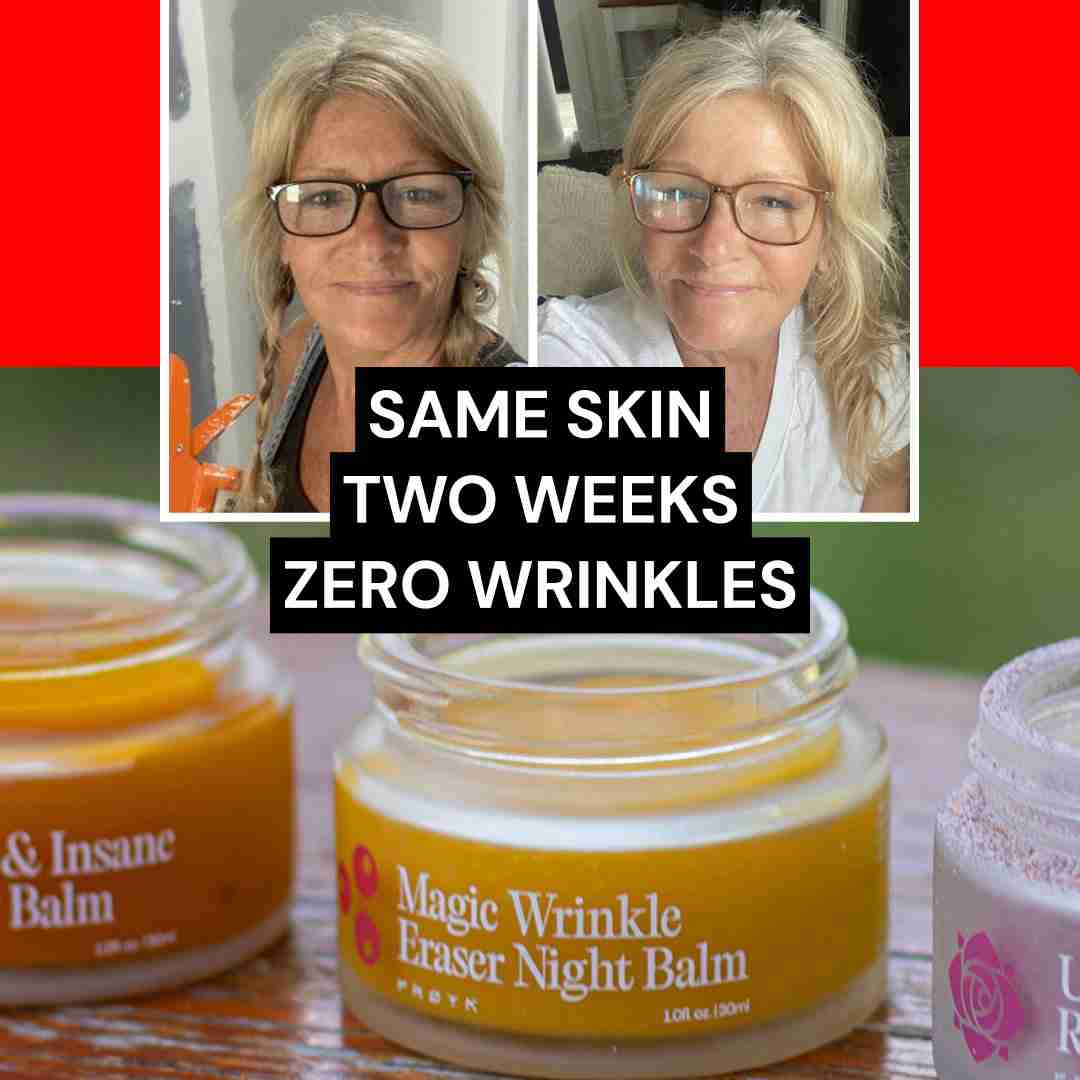 Skin angle for the same age group, framed as a formulation problem.